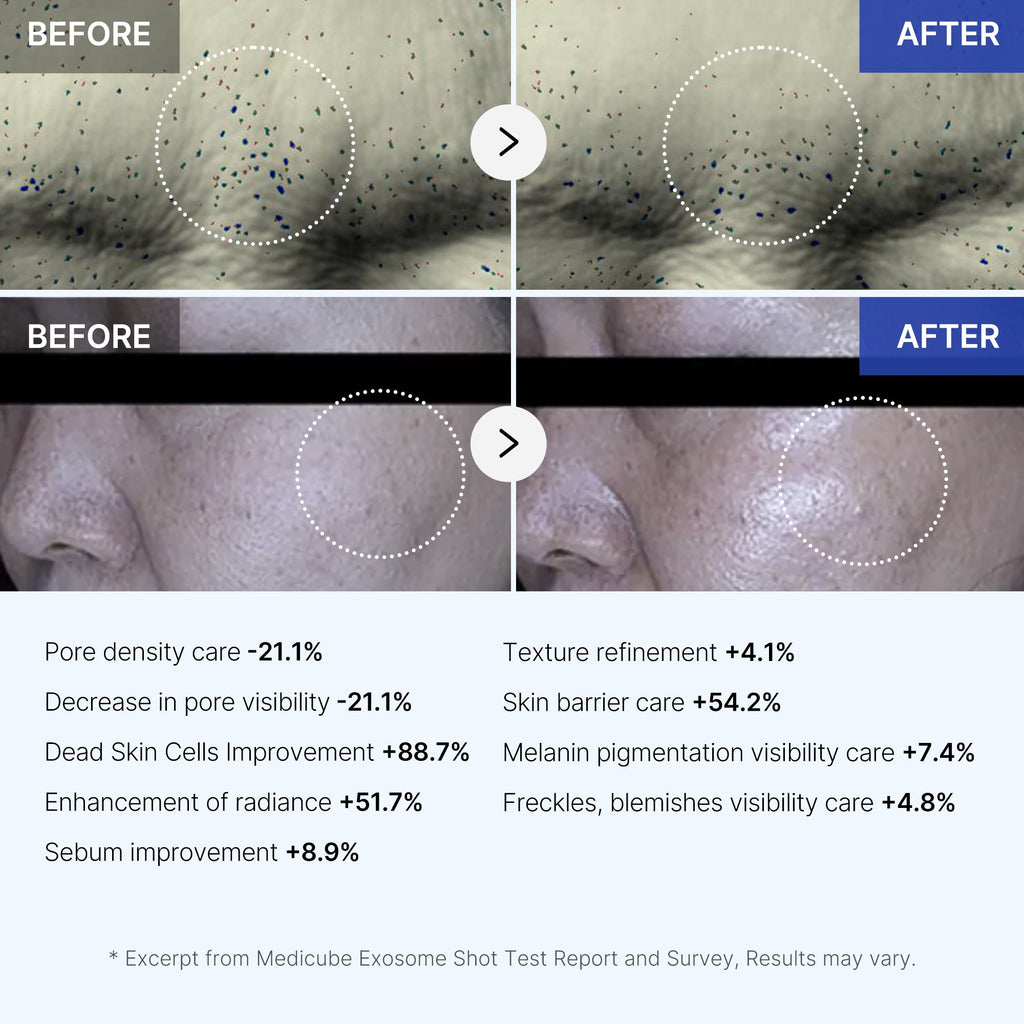 Set de Cuidado Facial Glass Glow de 7 Días a Precio Accesible