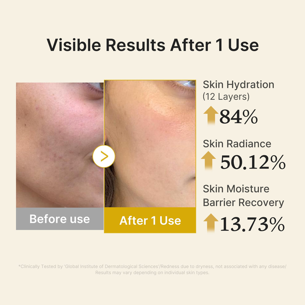Kojic Acid Turmeric Vitamin Gold Jelly Mist Sérum