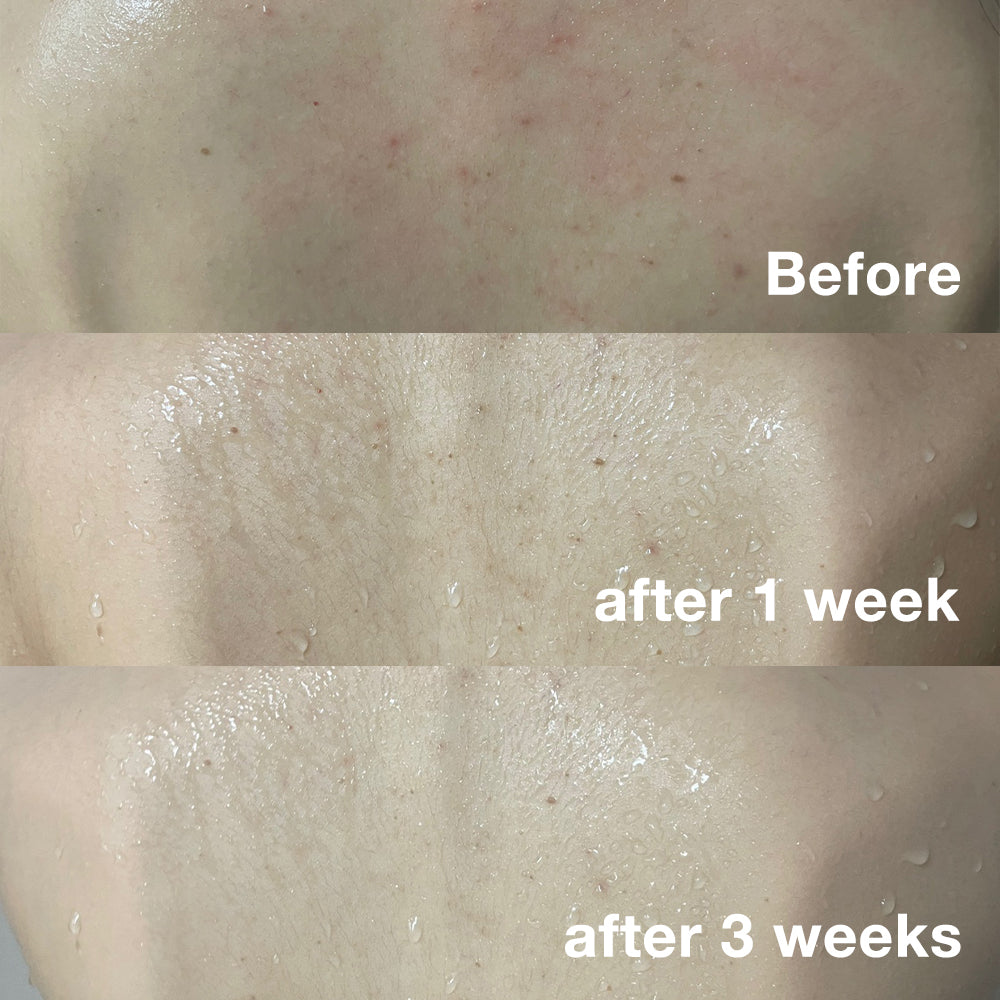 Set Definitivo de Cuidado Facial y Corporal Red Line